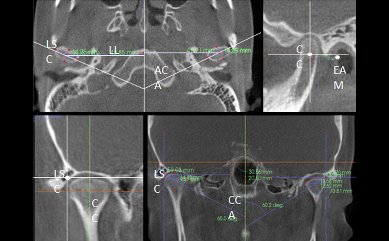 턱관절 3D CT 데이터를 면밀히 분석하는 모습